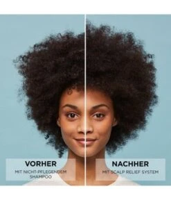 Nioxin Scalp Relief Sérum Cheveux -Soins Capillaires Boutique nioxin scalp relief haarserum 100 ml 3614228829311 visual3